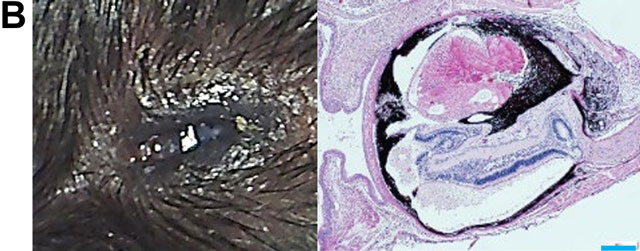 ノックアウトマウス（左：実体顕微鏡像; 右：組織染色像）。B. 小眼球。殆どの眼の組織に形成異常が起こっている。